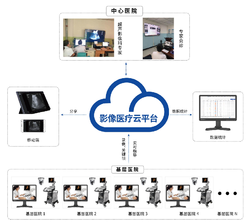 睿顯遠程超聲系統(tǒng)